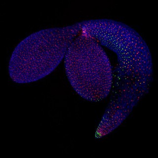 Confocal micrograph of Arabidopsis thaliana