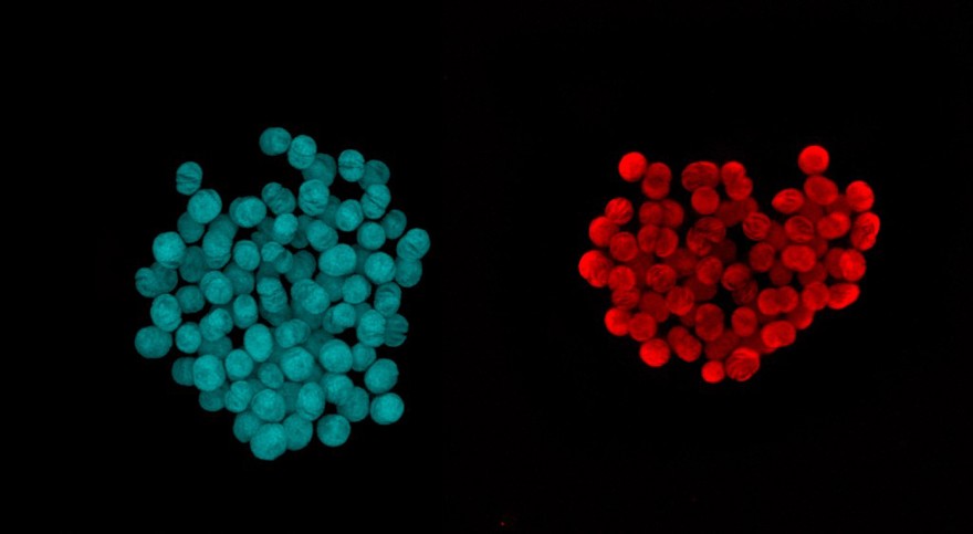 Confocal micrograph of chloroplasts