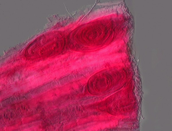 Trichinella spiralis