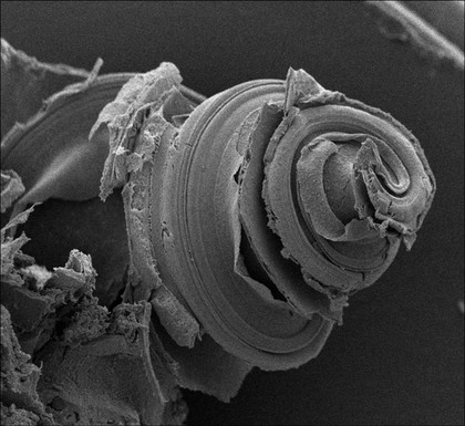 The cochlea is a vital part of our ear, allowing us to detect a wide range of frequencies of sound. This is a picture showing the characteristic snail shell structure of the cochlea in the inner ear, captured on a high-resolution electron microscope. The bone usually covering the cochlea has been removed to open up a window into the hidden world of hearing.