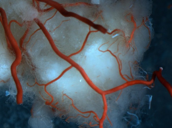 Vasculature of rat brain