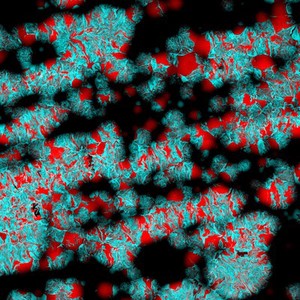 view Eschericia coli