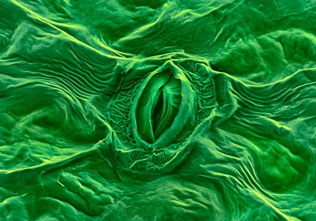 Feverfew stoma
