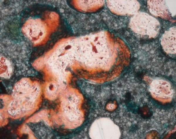 Bone regeneration