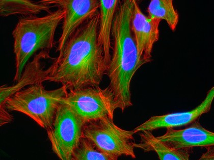 HeLa cells