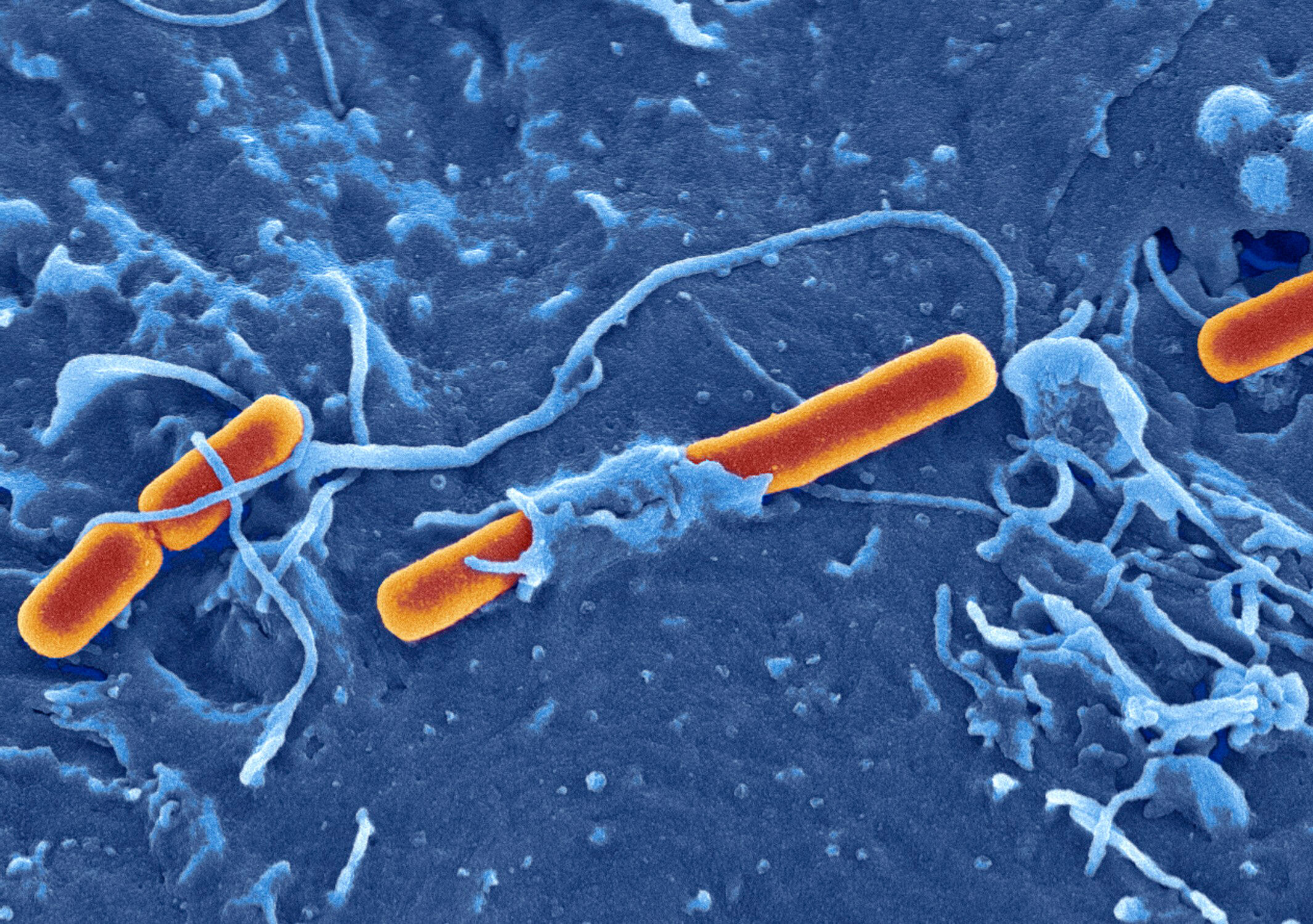 Shigella invading embryonic stem cell. David Goulding, Wellcome Trust Sanger Institute. 