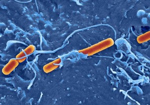 view Shigella flexneri invading embryonic stem cell