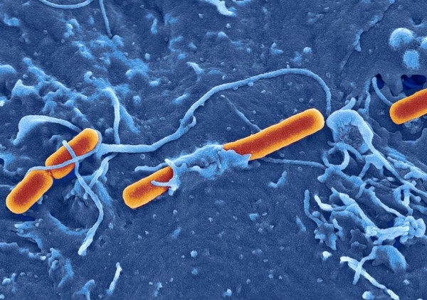 Shigella flexneri invading embryonic stem cell