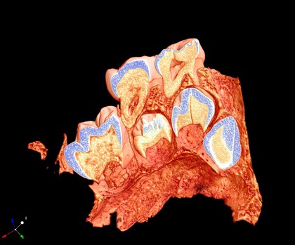 Upper jaw bone slice