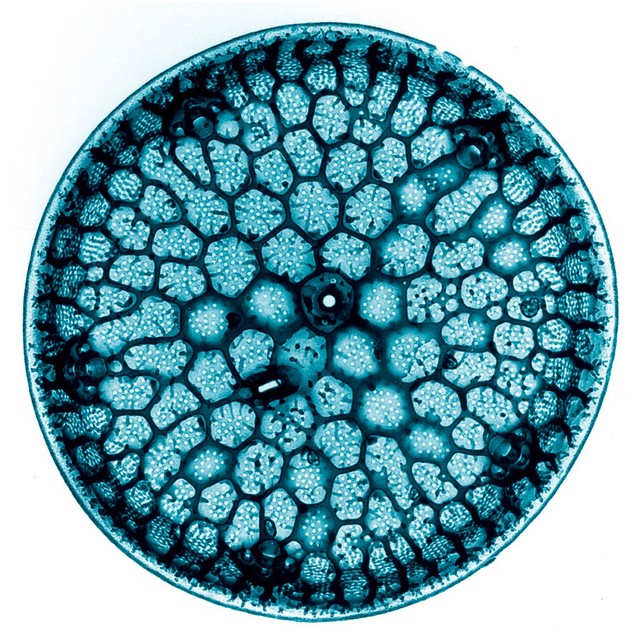 Centric Diatom | Wellcome Collection