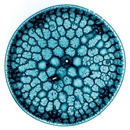Centric diatom