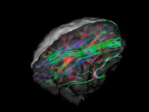 view White matter fibres of the uncinate fasciculus