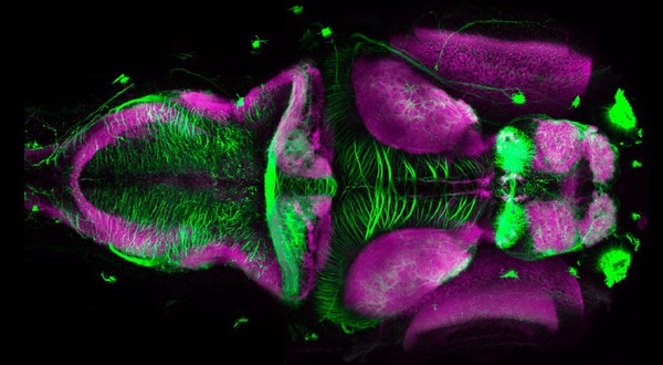 Zebrafish embryo