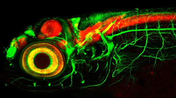 Zebrafish embryo