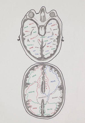 view Dementia