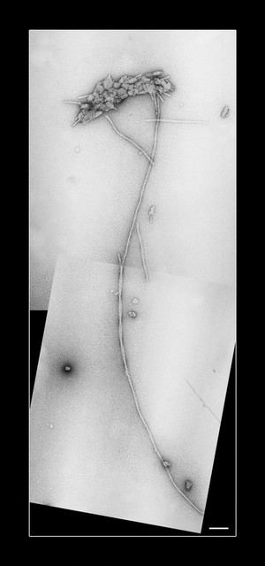 view Amyloid fibrils