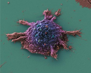 view Lung cancer cell