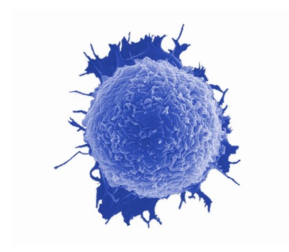 Human oral squamous carcinoma cell