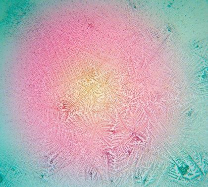 Human saliva displaying ferning. During the fertile phase of a woman's menstrual cycle an oestrogen surge causes salt crystals to appear in the saliva. When viewed under the microscope the crystalline salt structure resembles fern leaves and can be used as an indication of a woman's increased chances of conceiving at this time.