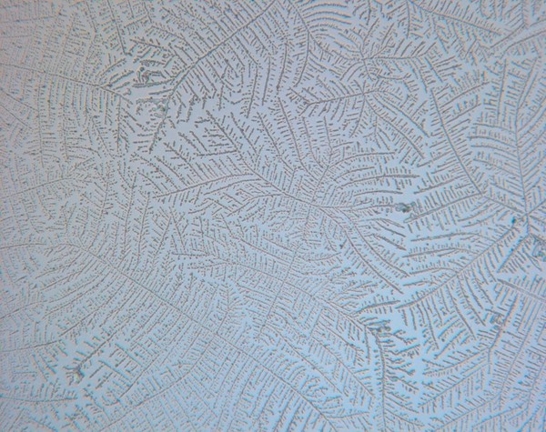 Human saliva displaying ferning. During the fertile phase of a woman's menstrual cycle an oestrogen surge causes salt crystals to appear in the saliva. When viewed under the microscope the crystalline salt structure resembles fern leaves and can be used as an indication of a woman's increased chances of conceiving at this time.
