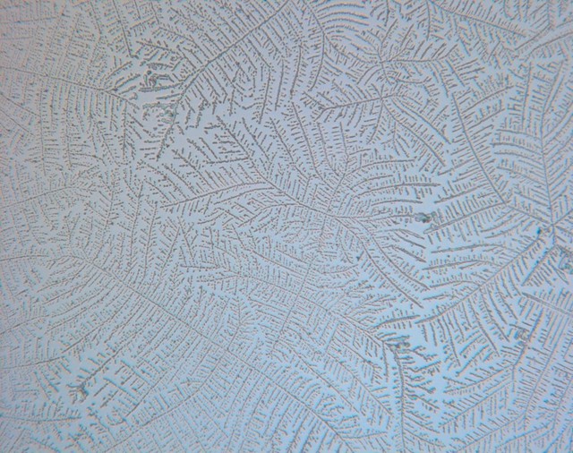 Human saliva displaying ferning. During the fertile phase of a woman's menstrual cycle an oestrogen surge causes salt crystals to appear in the saliva. When viewed under the microscope the crystalline salt structure resembles fern leaves and can be used as an indication of a woman's increased chances of conceiving at this time.