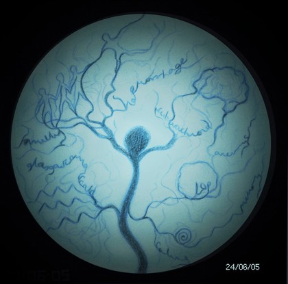 Pencil and ink illustration of an angiogram