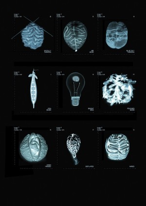 view Artworks of the Brain as b/w negative images