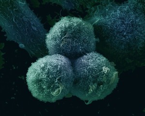 view Cell cultured lung cancer cells, SEM