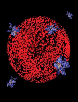 Prostate cancer cells treated with nano sized drug carriers