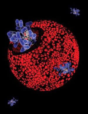 view Prostate cancer cells treated with nano sized drug carriers