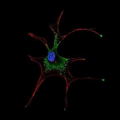 Melanocyte deficient in myosin 5a