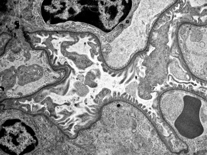 Mouse renal glomerulus (Mus musculus)