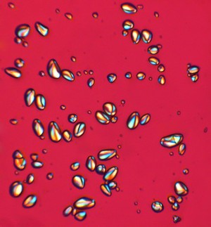 view Potato starch grains (Solanum tuberosum)