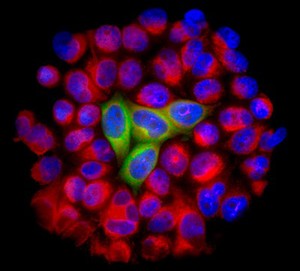 view HeLa cells expressing the protein survivin