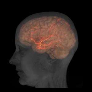 view Head, brain and large arteries of a healthy female adult, MRI