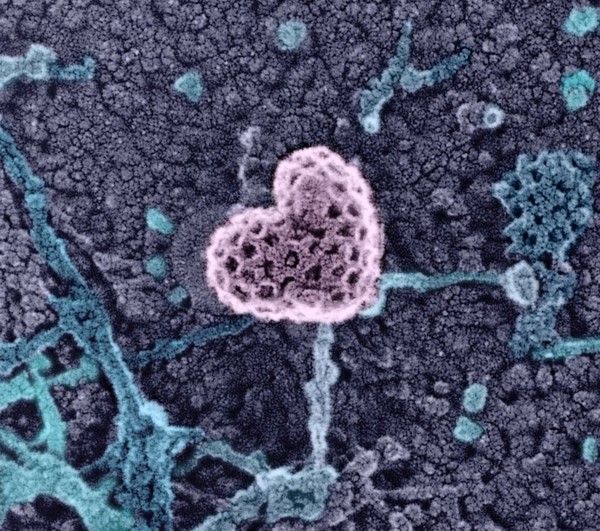 Clathrin-coated pit, inner leaflet of the plasma membrane