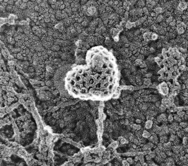 Clathrin-coated pit, inner leaflet of the plasma membrane