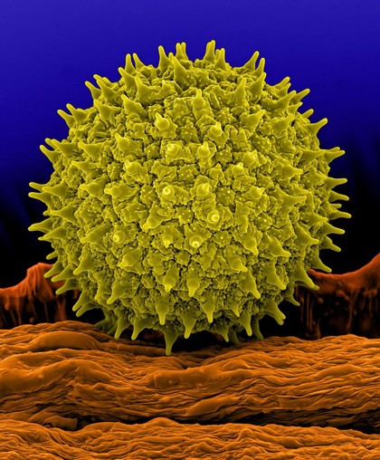 Pollen grain, common morning glory (Ipomoea purpurea)