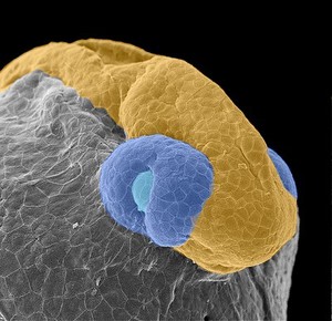 view Central nervous system, Zebrafish embryo