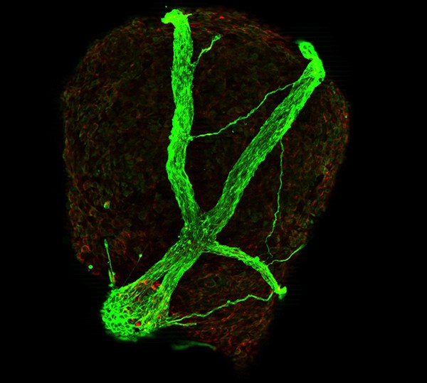 Neurone development, embryoid body