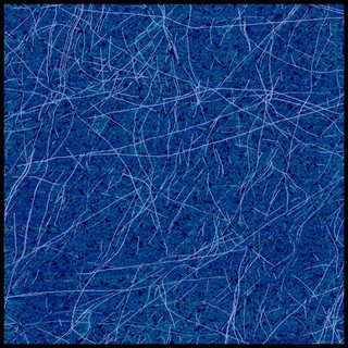 Amyloid fibrils, AFM