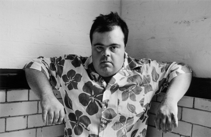 Adult with Down's syndrome