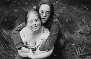 view Adults with Down's syndrome