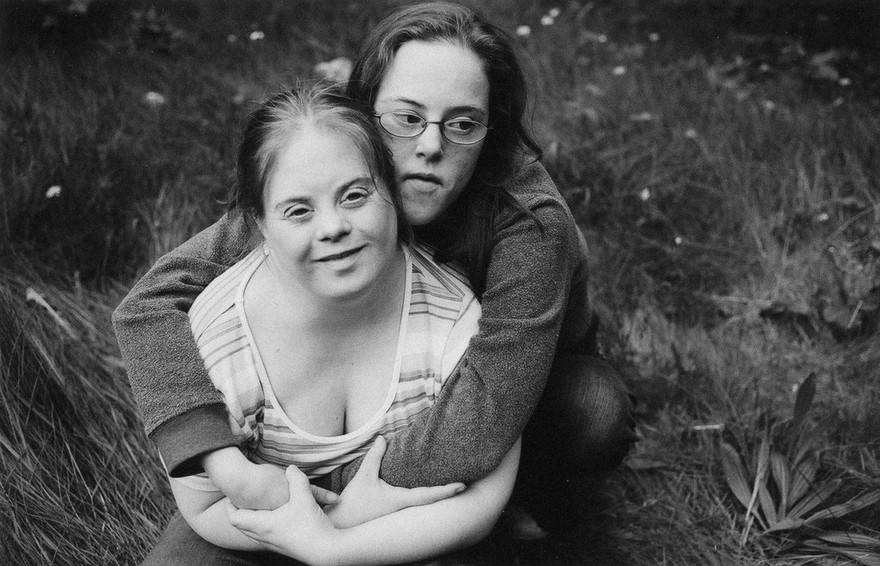 Adults with Down's syndrome