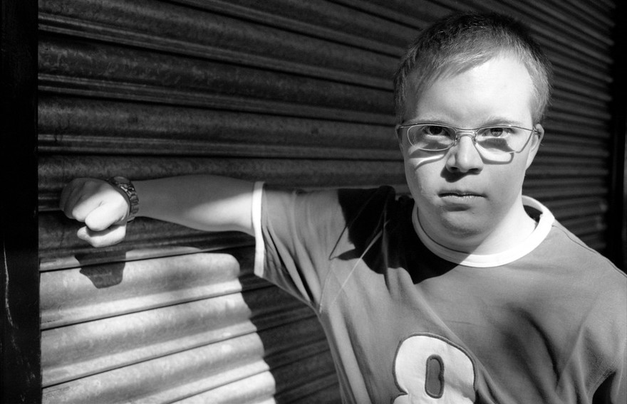 Adult with Down's syndrome