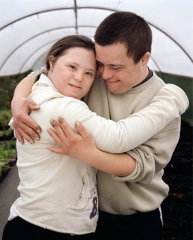 Adult couple with Down's syndrome