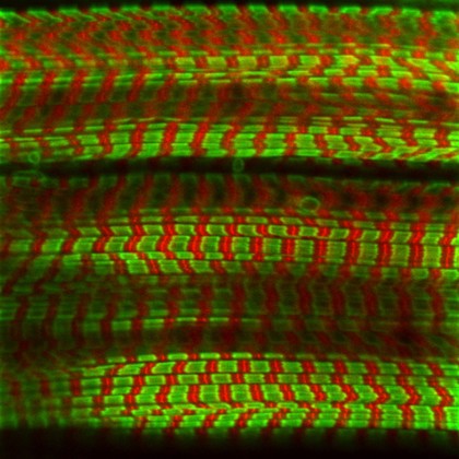 Wild-type Muscle Sarcomere, Drosophila larva