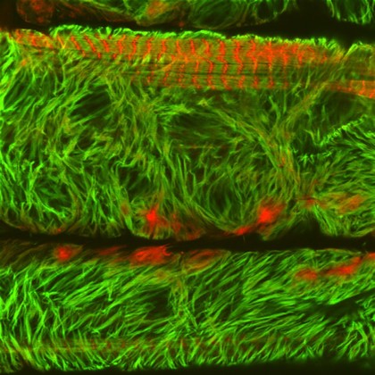 Mutant Muscle Sarcomere, Drosophila larva
