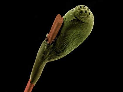 Head louse egg attached to a strand of hair, SEM.