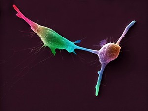 view Macrophages infected with Candida yeast spores, SEM